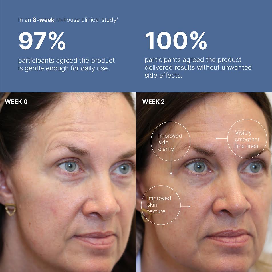 ageLOC Tru Face Peptide Retinol Complex
