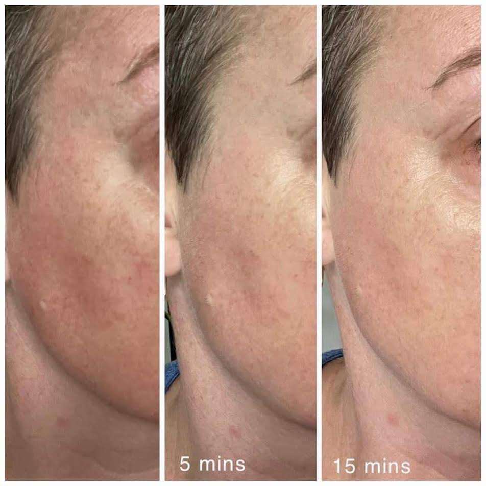Cica Balm