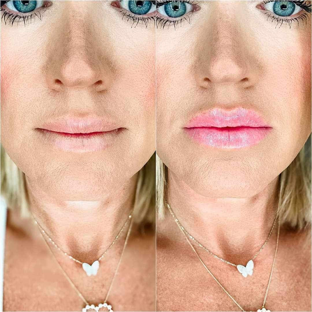 2 tubes LightShine Lip Plumping Balm